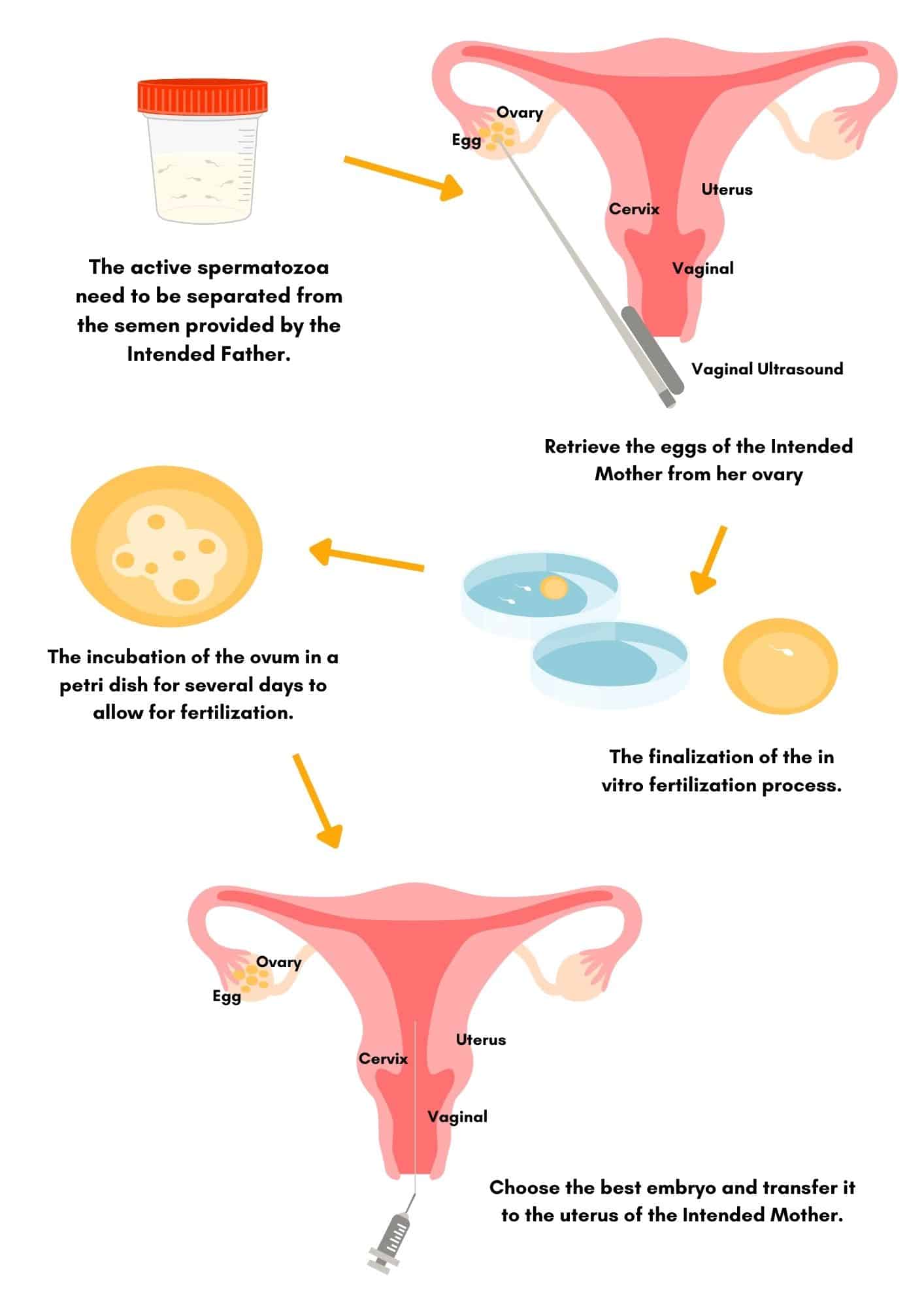 Process Of In Vitro Fertilization Ivf Asia Group 